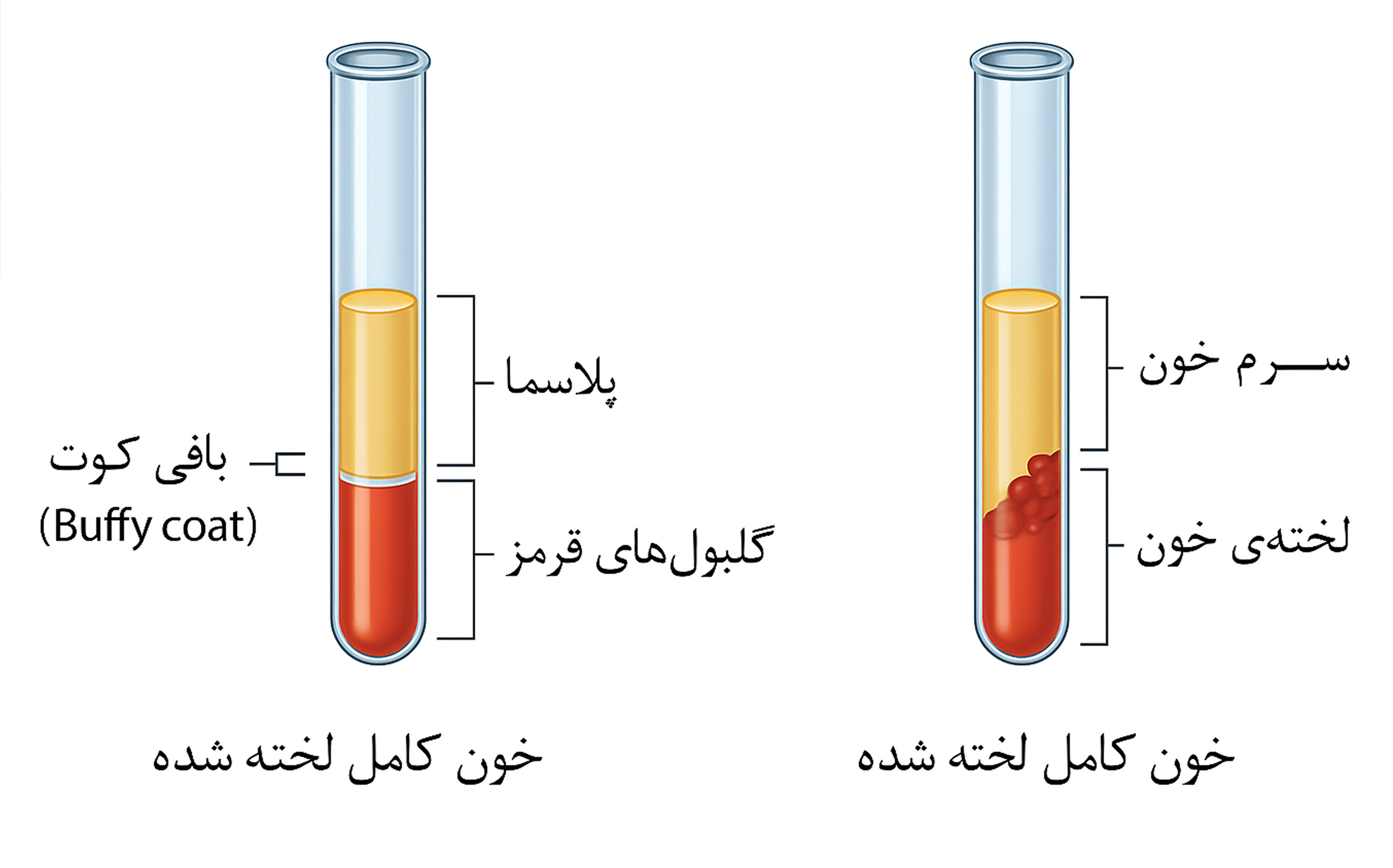 لختگی پلاسما | شرکت پلاسما خوارزمی